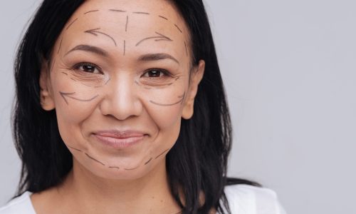 You do not need that. Healthy looking Asian lady demonstrating pre surgery guidelines on her face while smiling and standing isolated on white background